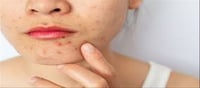 Bad Habits that are messing with your Dark Spots!!!